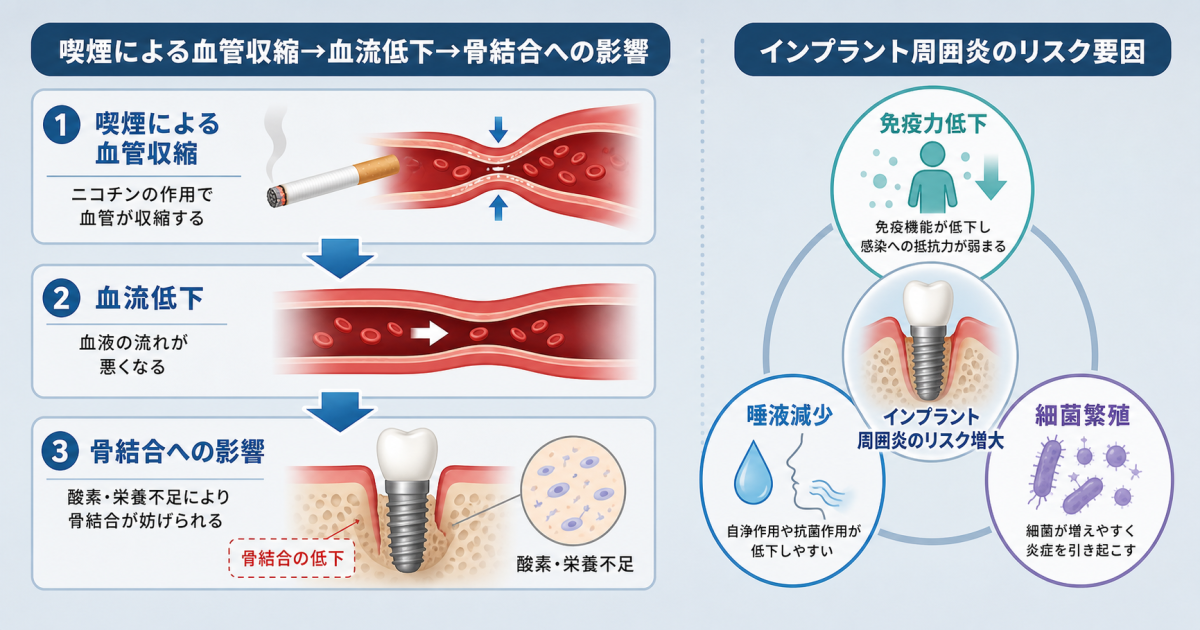 ■タバコがインプラントに与える影響とは