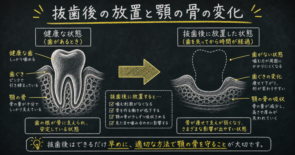 抜歯後の放置で老け顔に？骨が痩せるリスクと対策を歯科医が解説