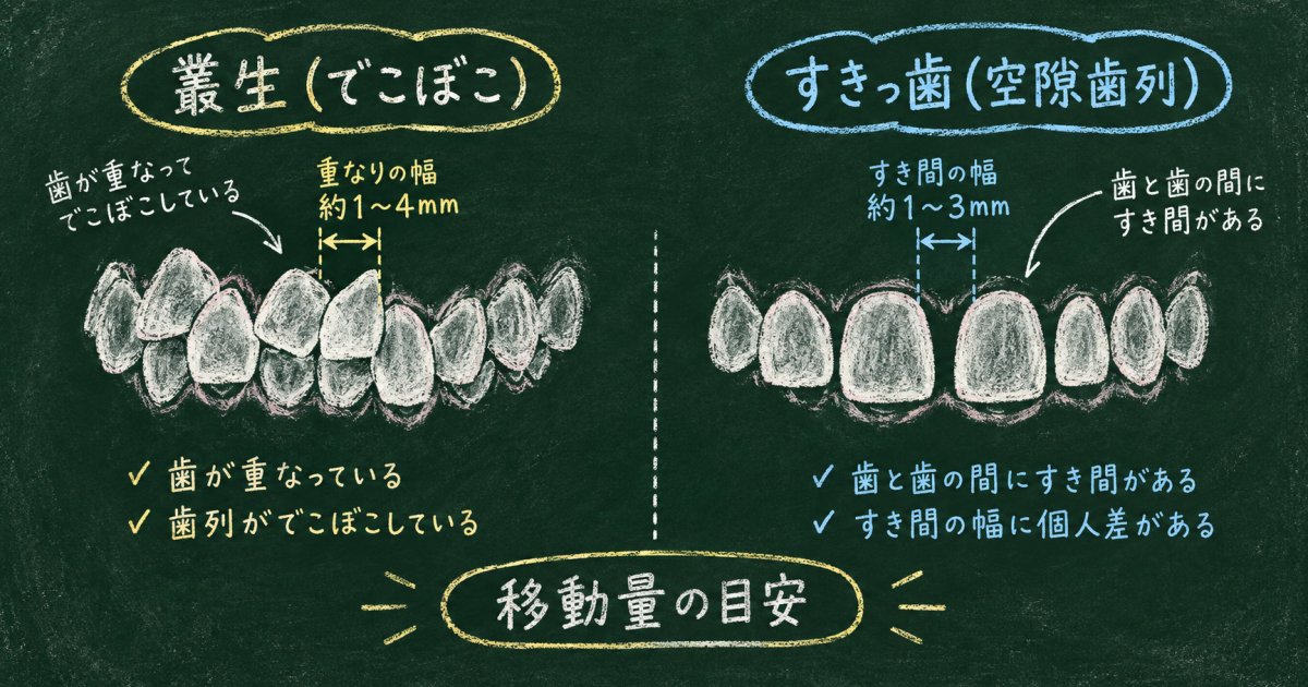 マウスピース矯正できる症例|叢生・すきっ歯の目安