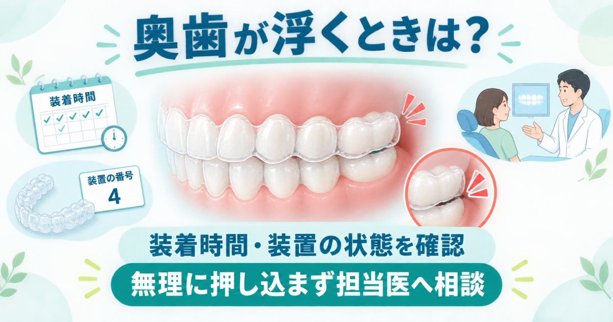 マウスピース矯正が進まない？奥歯の浮きと装着不足の原因を確認