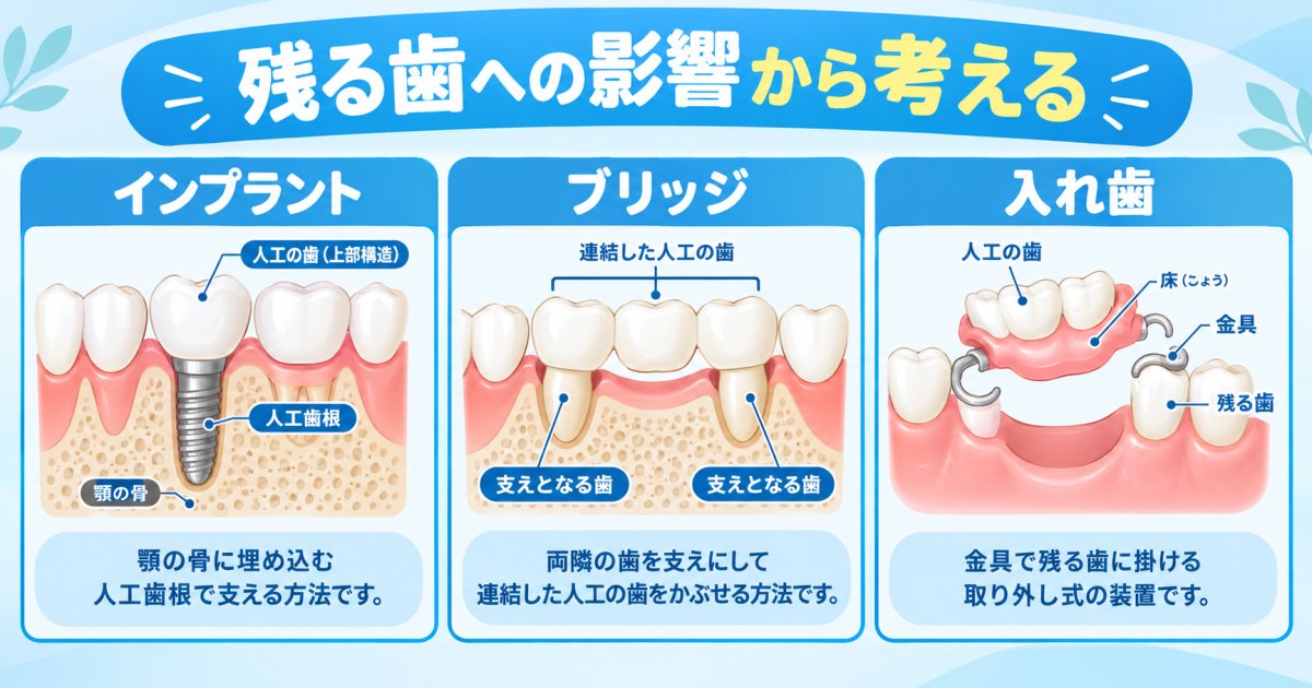 歯を失った後の治療選択肢は、残る歯への影響から考える